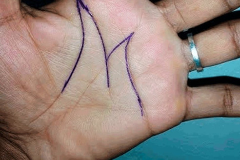 Буква «М» на ладони - это не удача, а кардио-сканер: проверьте свои сосуды в 2026 году